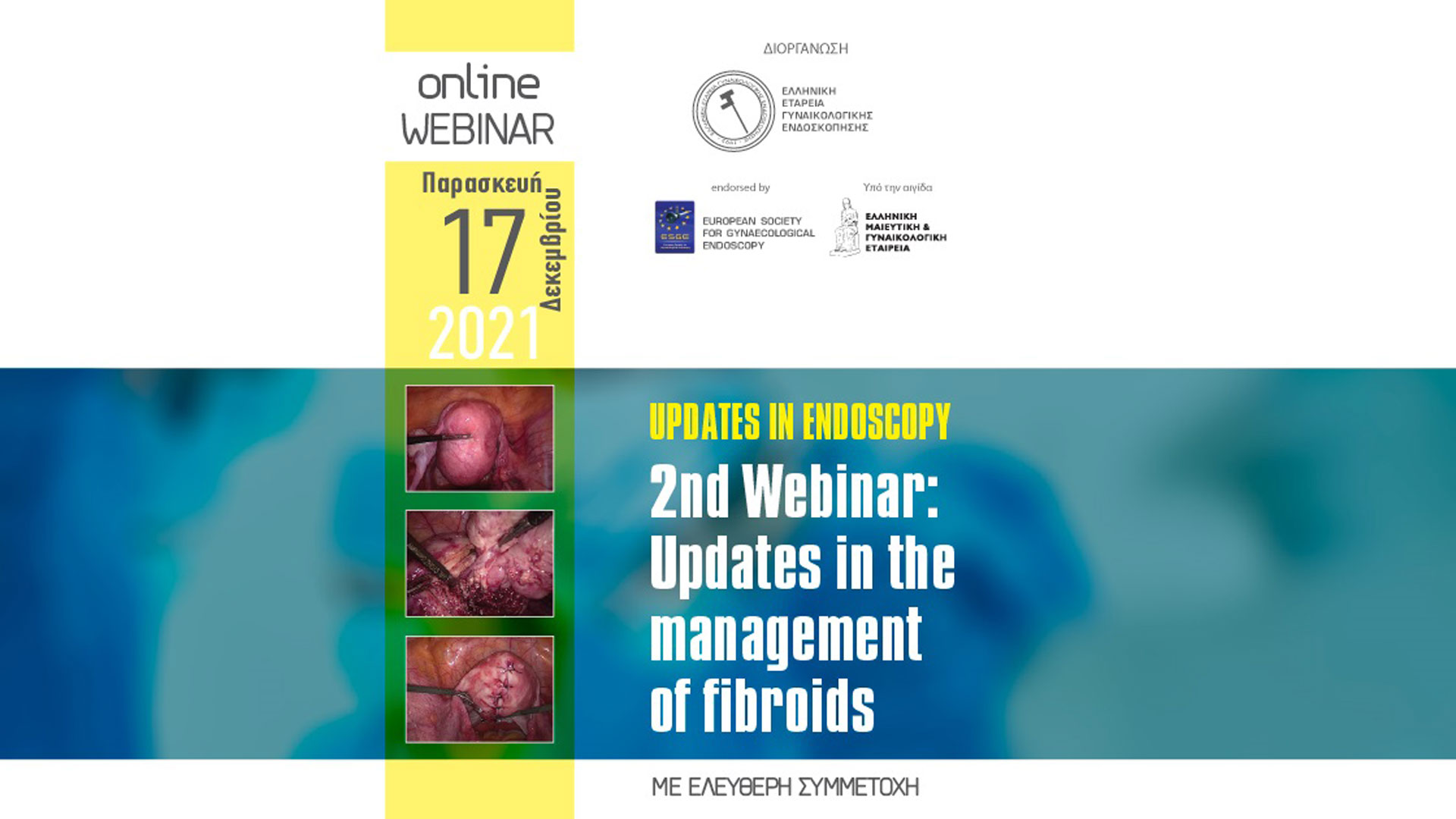 Updates in Gynecological Endoscopy - 2nd Webinar: Updates in the management of fibroids